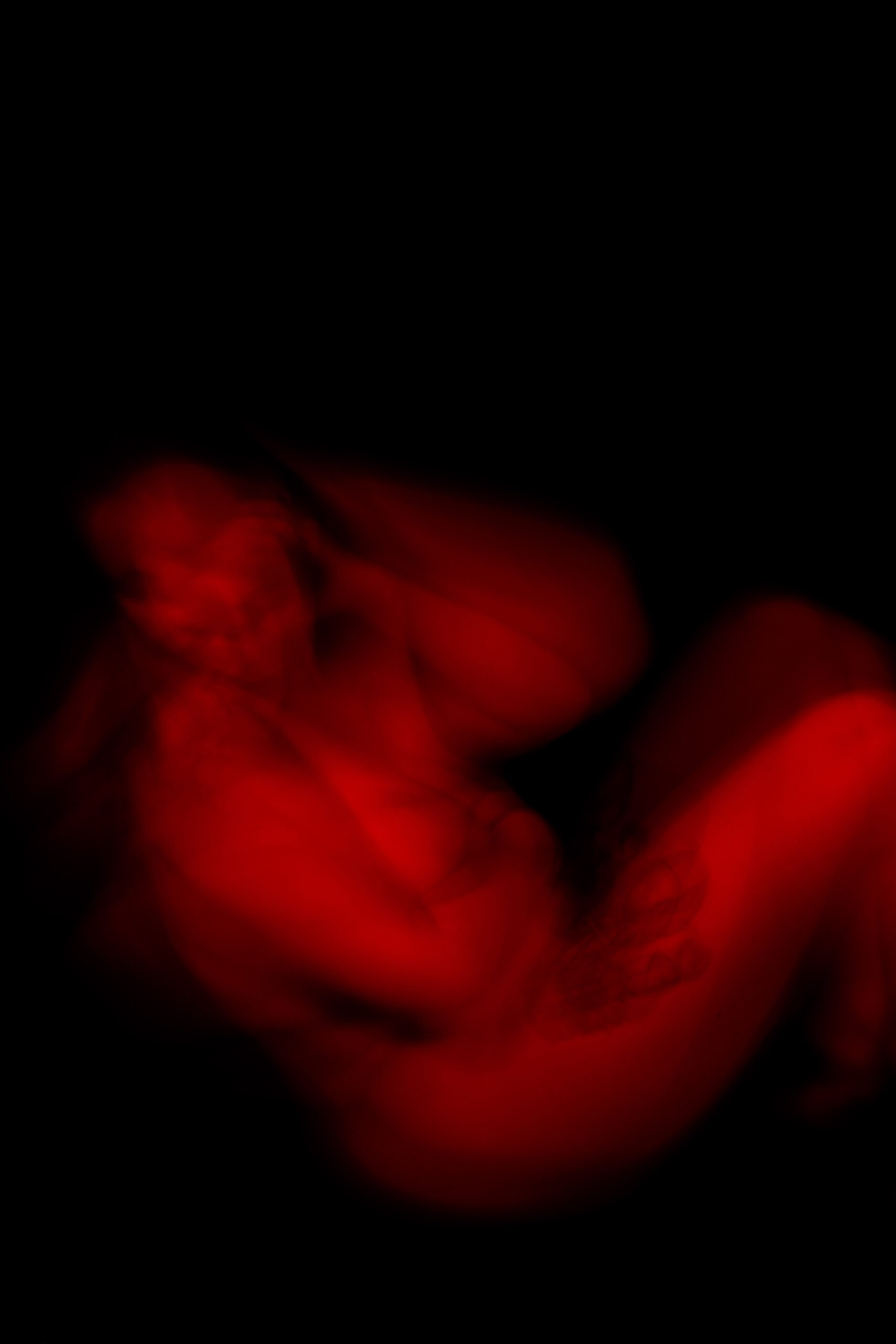 20260305_Christie_Endo South Coast x Phoebe Wingrove_LR-39